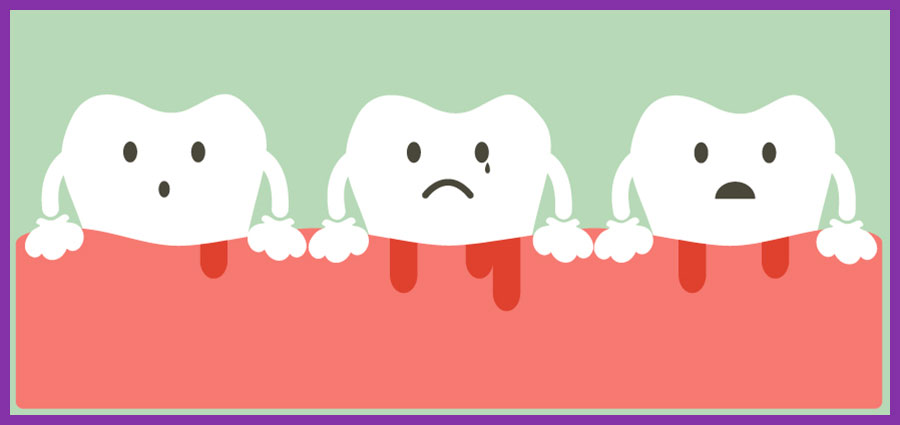 Cartoon graphic of teeth with bleeding gums